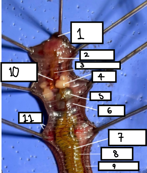 <p>Where is the intestine located?</p>