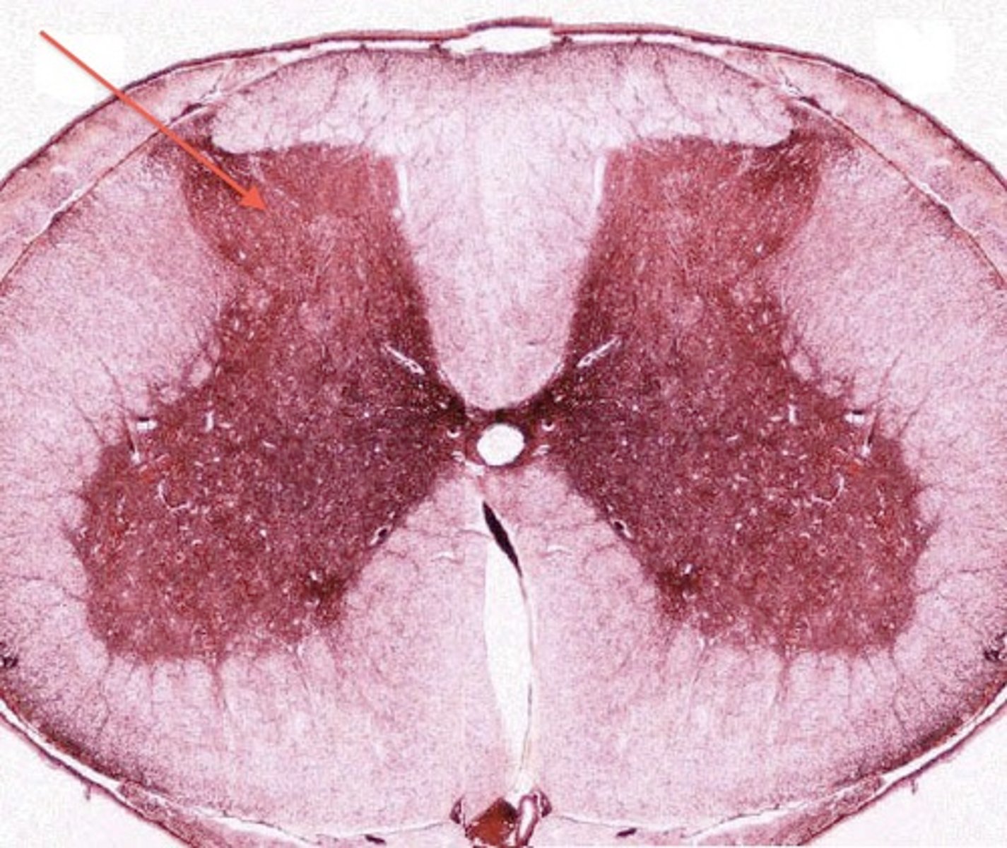 <p>made up of unmyelinated axons and cell bodies. Slower signal transmission. inner layer of spinal cord.</p>