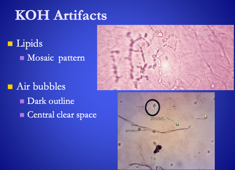 <p>KOH wet mount Artifacts</p><ul><li><p><span>Lipids</span> – mosaic pattern</p></li><li><p><span><strong>[...]</strong></span> – dark outline &amp; central clear space&nbsp;</p></li><li><p>KOH crystals are long and thin</p></li><li><p>Cotton fibers are large, long rough tipped stalks</p></li><li><p>Synthetic fibers are smooth long and curving</p></li></ul><p></p>