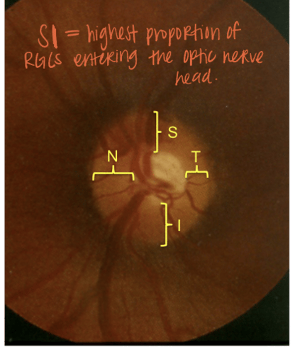 <p>Does this nerve follow the ISNT rule?</p>