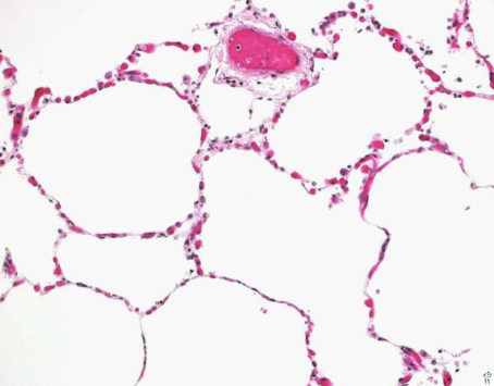 <p>Name this tissue</p>