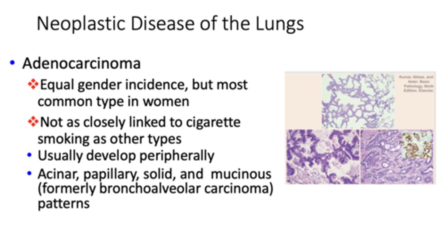 <p>adenocarcinoma</p>