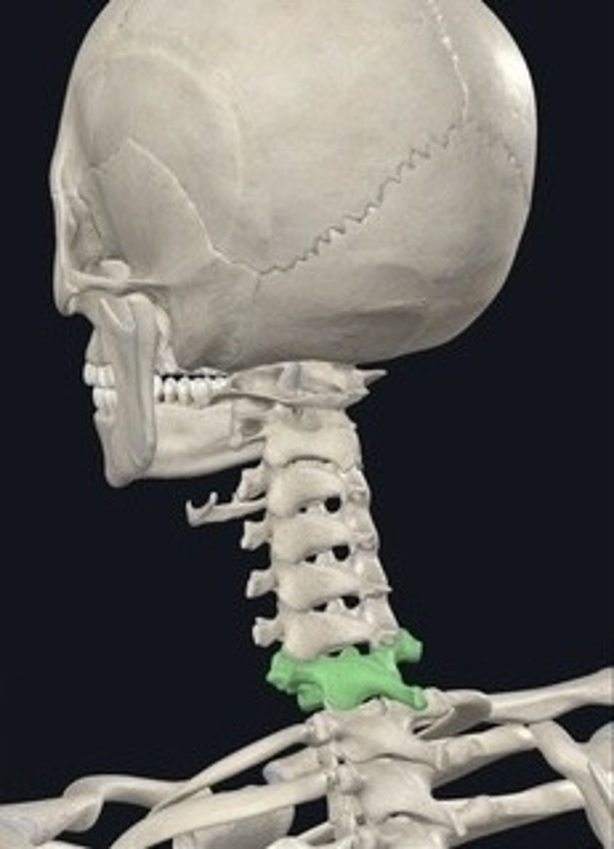 <p>C7 vertebra, prominent at the neck base.</p>