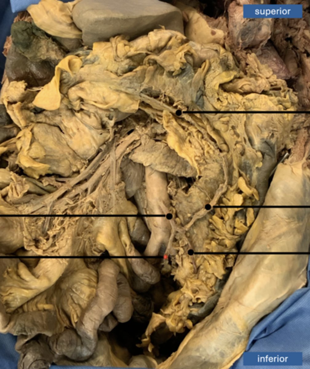 <p>artery</p>