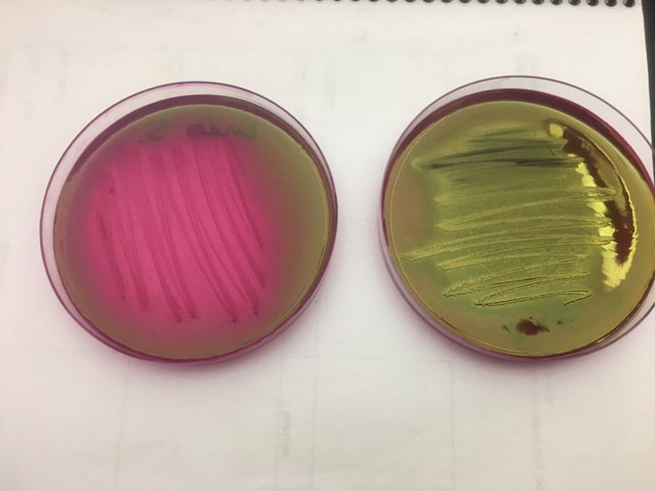 <p>is the right or left positive for Salmonella sp.</p>
