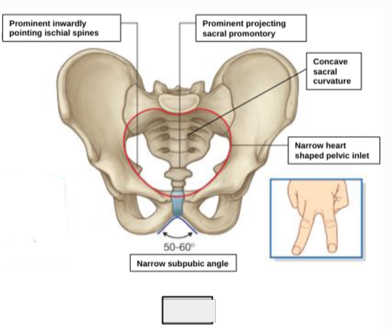 <p>male or female pelvis?</p>