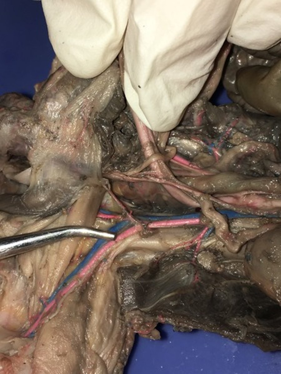 <p>External iliac artery</p>