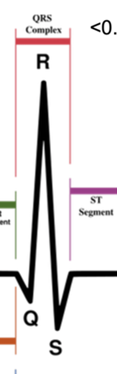 <p>ventricular depolarization</p>