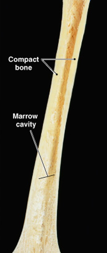 <p>Which part of the long bone is:</p><ul><li><p>The shaft</p></li><li><p>A heavy wall compact bone</p></li><li><p>A central space called marrow cavity</p></li></ul><p></p>