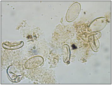 <p>What does Eimeria stiedae cause in rabbits?</p>