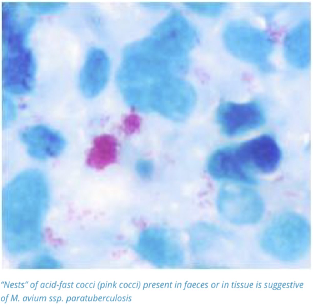 <p>Staining of Faeces or Rectal mucosa for the presence of acid-fast cocci usually present in clumps or nests. Presumptive and must be followed by culture</p>