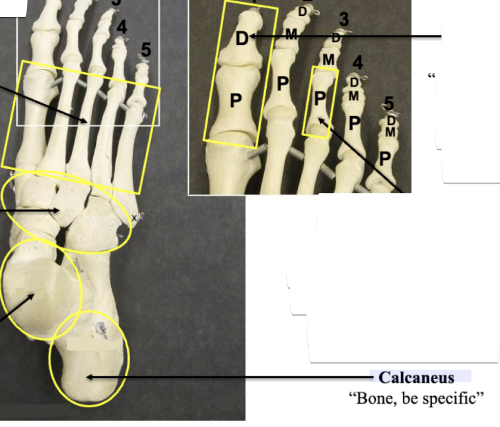 <p>Calcaneus</p>