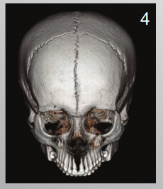 <p>What is 4</p>