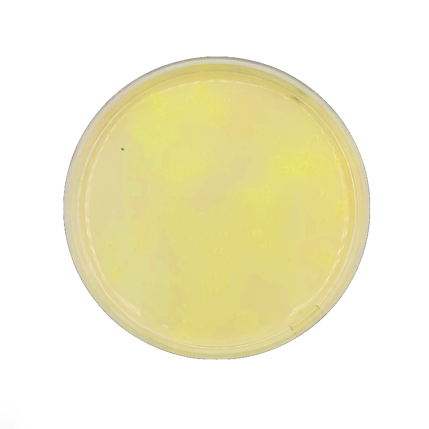 <p>Nombre del agar (color amarillo muy amarillo no claro, amarillo concentrado color pipi de borracho), y su utilidad diagnóstica</p>