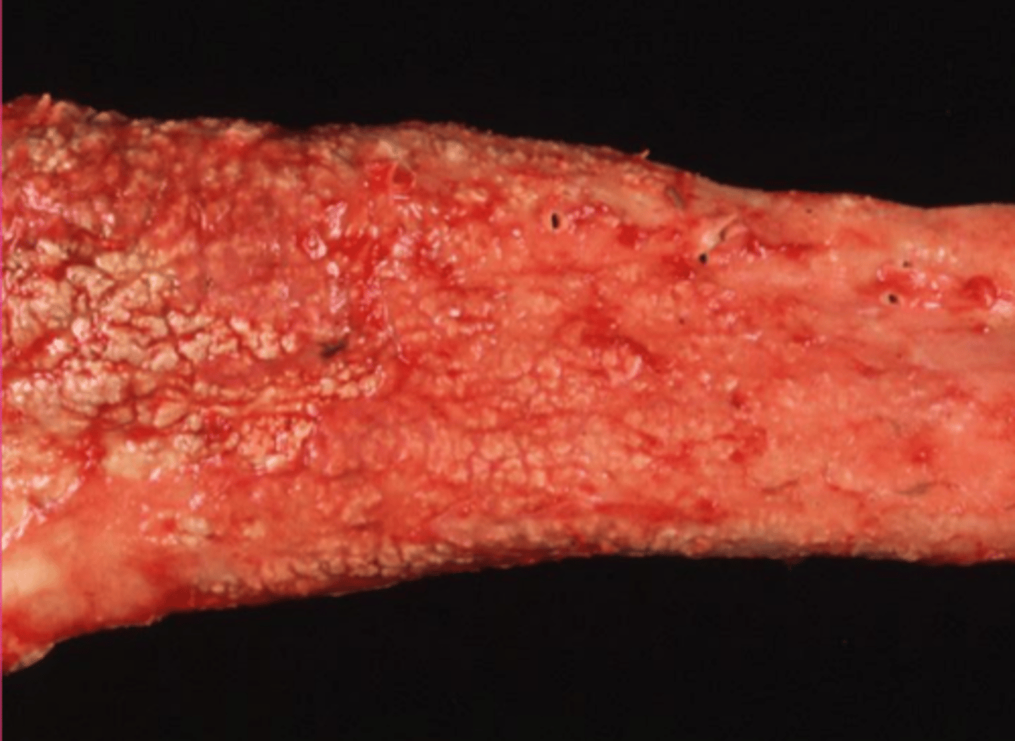 <p>what would make this aorta look like that?</p>