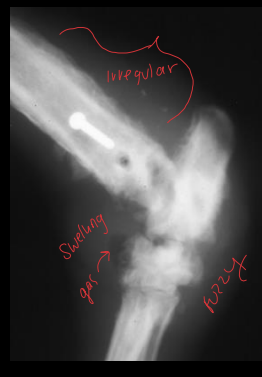 <p>Septic Arthritis</p>