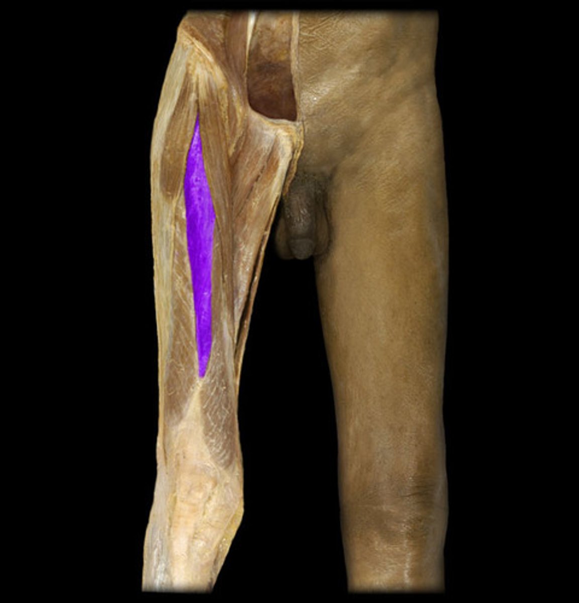 <p>Rectus femoris</p>