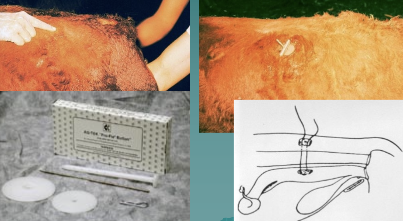 <p>what is this fixation method?</p>