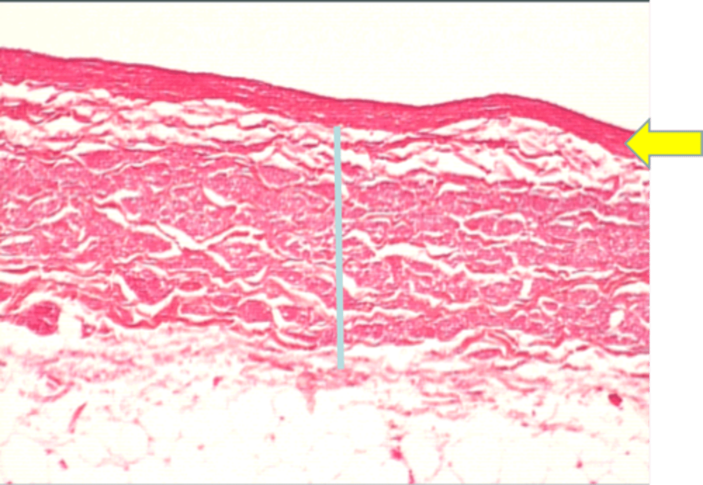 <p>ID tissue</p><p>large vein</p>