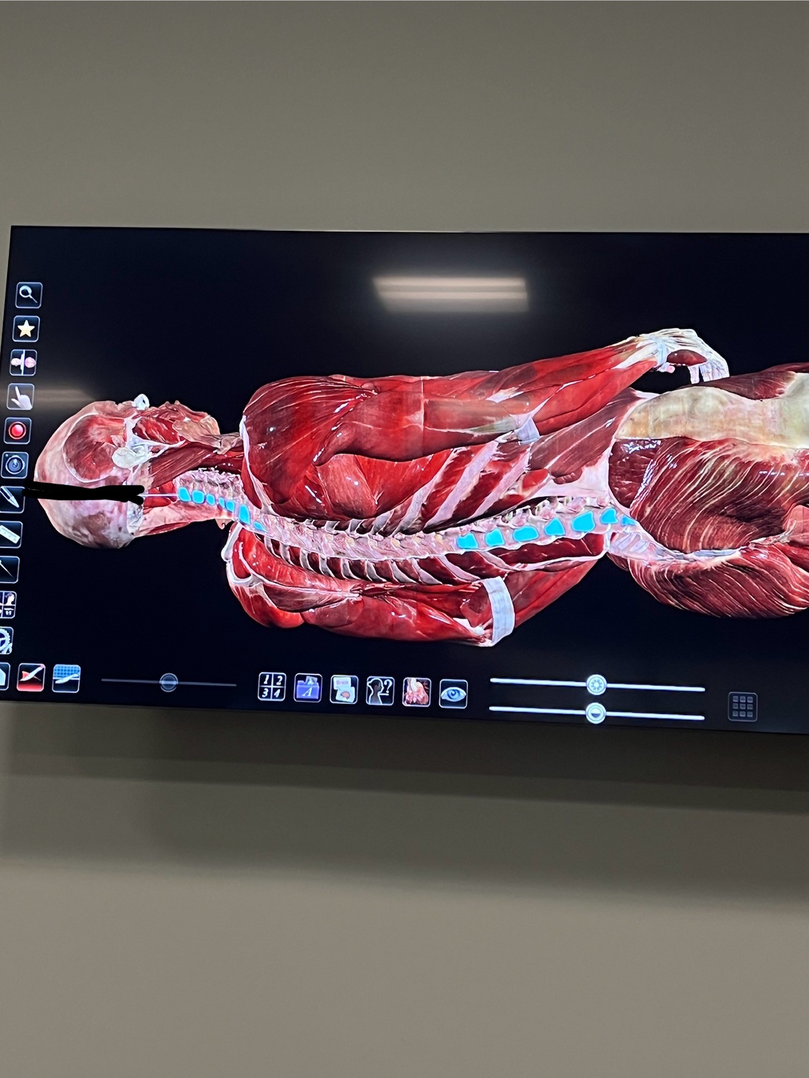 <p>What spinal muscle is this</p>
