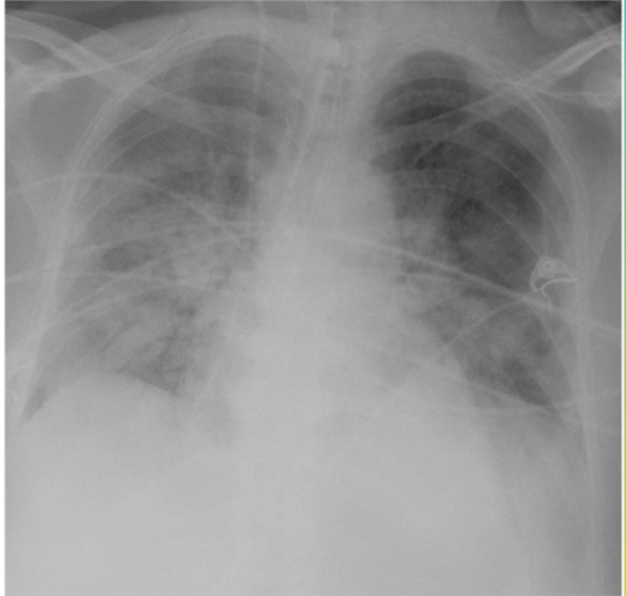 <p>Name the condition</p>