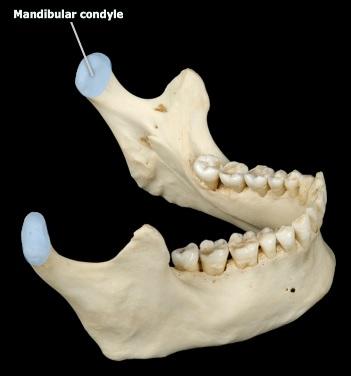 <p><span>mandibular condyle</span></p>
