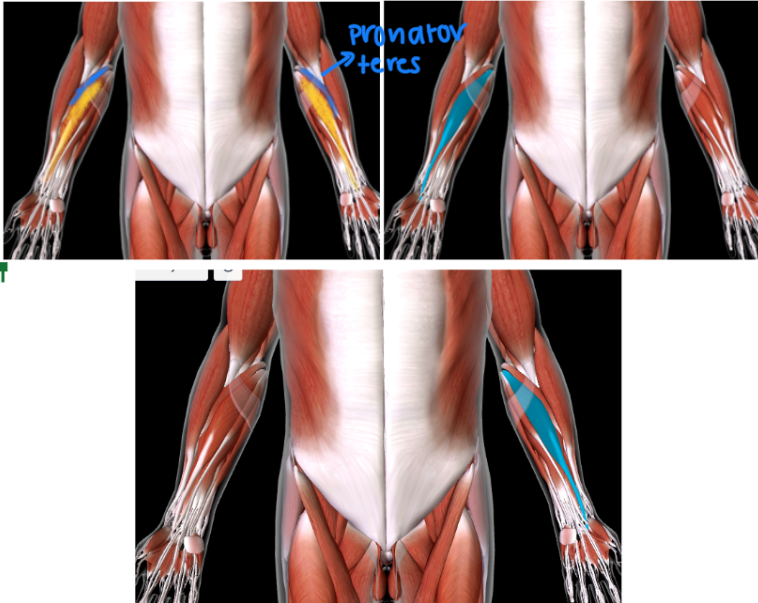 <p>Function:<strong> FLEX/ABDUCT WRISTS</strong></p><p>Origin: <strong>MEDIAL EPICONDYLE </strong>of <strong>HUMERUS</strong> </p><p>Insertion: <strong>SECOND/THIRD METACARPALS </strong></p><ul><li><p><strong>MEDIAL to the PRONATOR TERES</strong></p></li></ul><p></p>