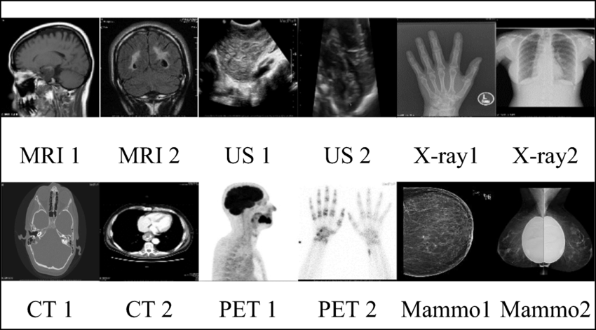 <ol><li><p>attenuation</p><ul><li><p>radiographs: radiolucent, semi-radiopaque, radiopaque</p></li><li><p>MRI: void, intermediate signal intensity, high signal intensitiy</p></li><li><p>ultrasound: anechoic (black), hypoechoic, hyperechoic (bright)</p></li></ul></li><li><p>radiological characteristics (fracture classification)</p><ul><li><p>comminuted</p></li><li><p>spiral</p></li><li><p>rotation</p></li><li><p>linear</p></li><li><p>transverse</p></li><li><p>oblique</p></li><li><p>compression</p></li><li><p>displaced (and how)</p></li><li><p>greenstick</p></li><li><p>stress</p></li><li><p>pathological</p></li><li><p>open</p></li></ul></li><li><p>location</p></li></ol><p></p>