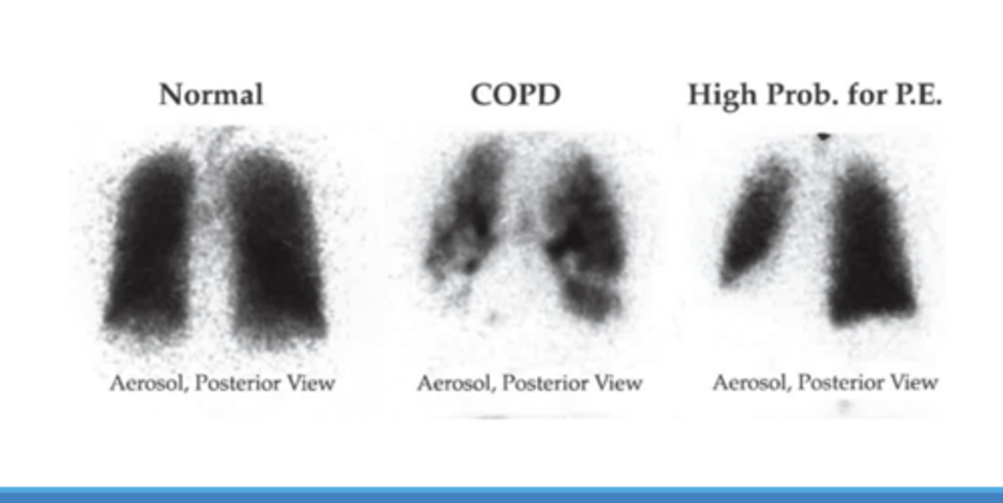<p>How much RBC is being taken up at the capillaries and how much O2 is being taken up. (tagged RBCs also used)</p>