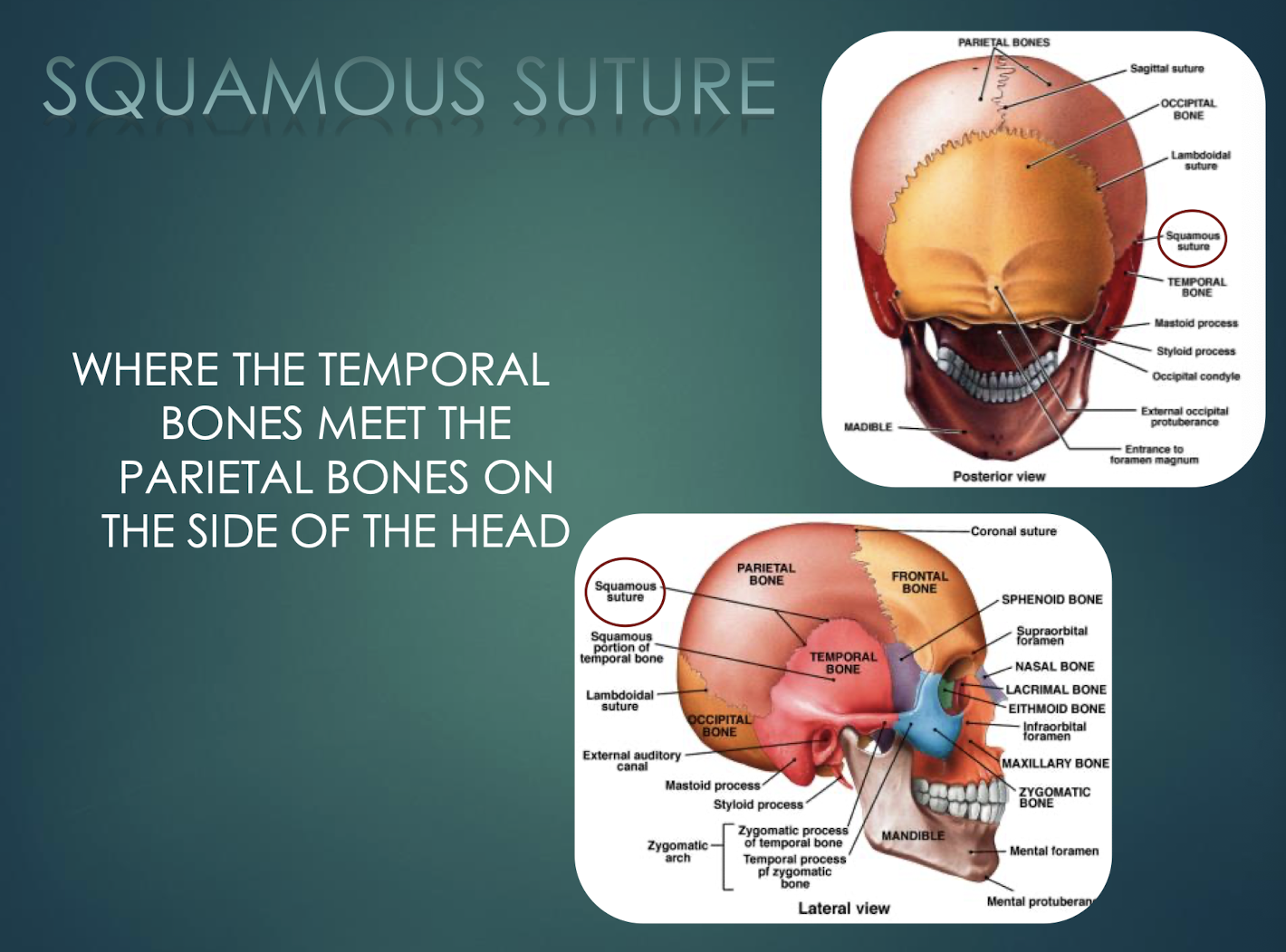 <p>Squamous Suture</p>