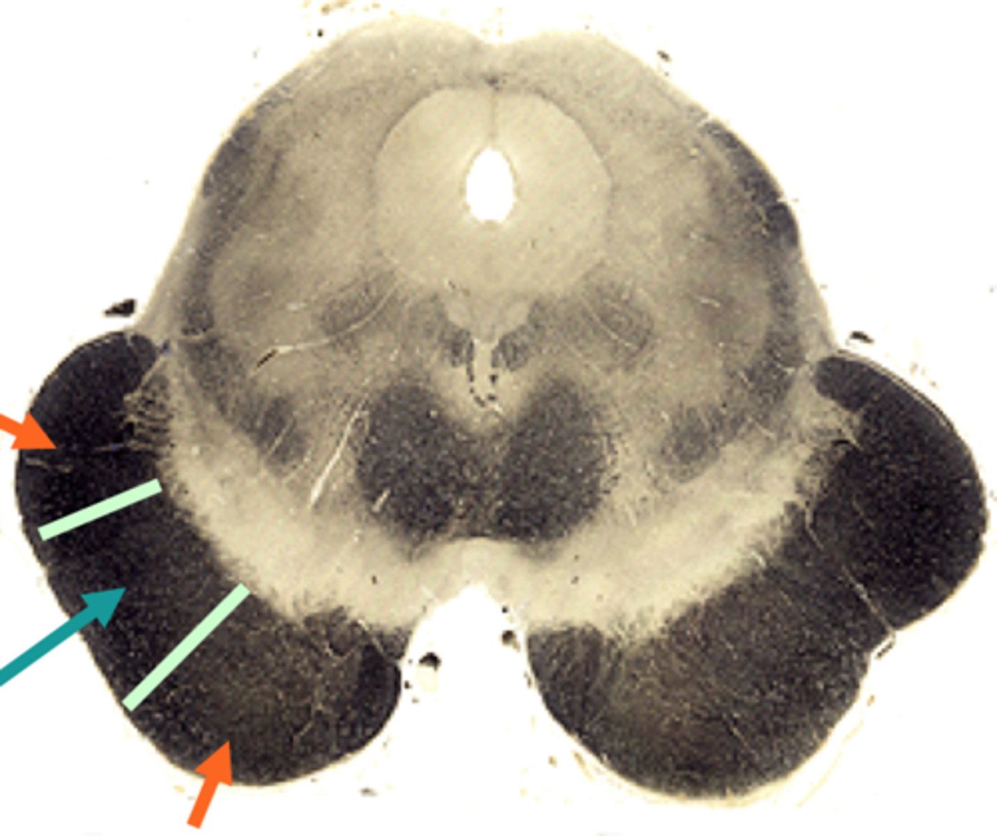 <p>axons synapse with nuclei in pons</p>