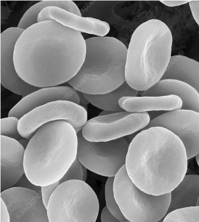 <p><span>What cell type is in the picture below?</span></p>