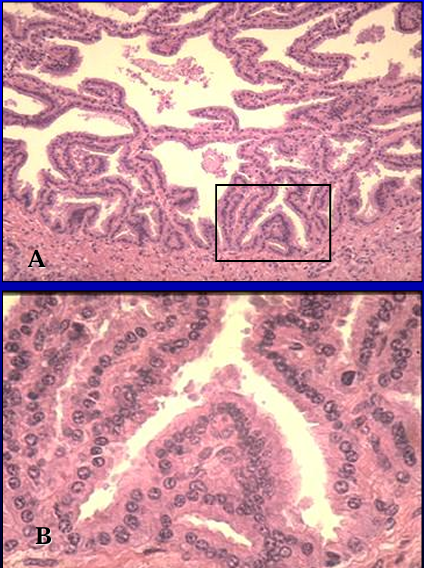 <p>Identify the structure:</p><p>Specie:</p><p>Lined by:</p>