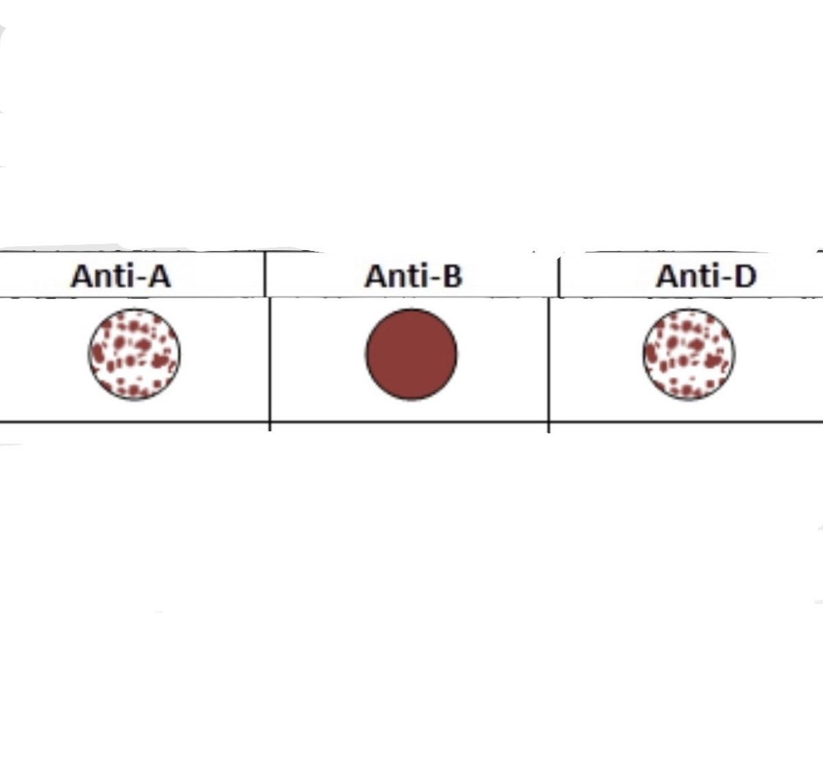 <p>What is this Blood Type? </p>
