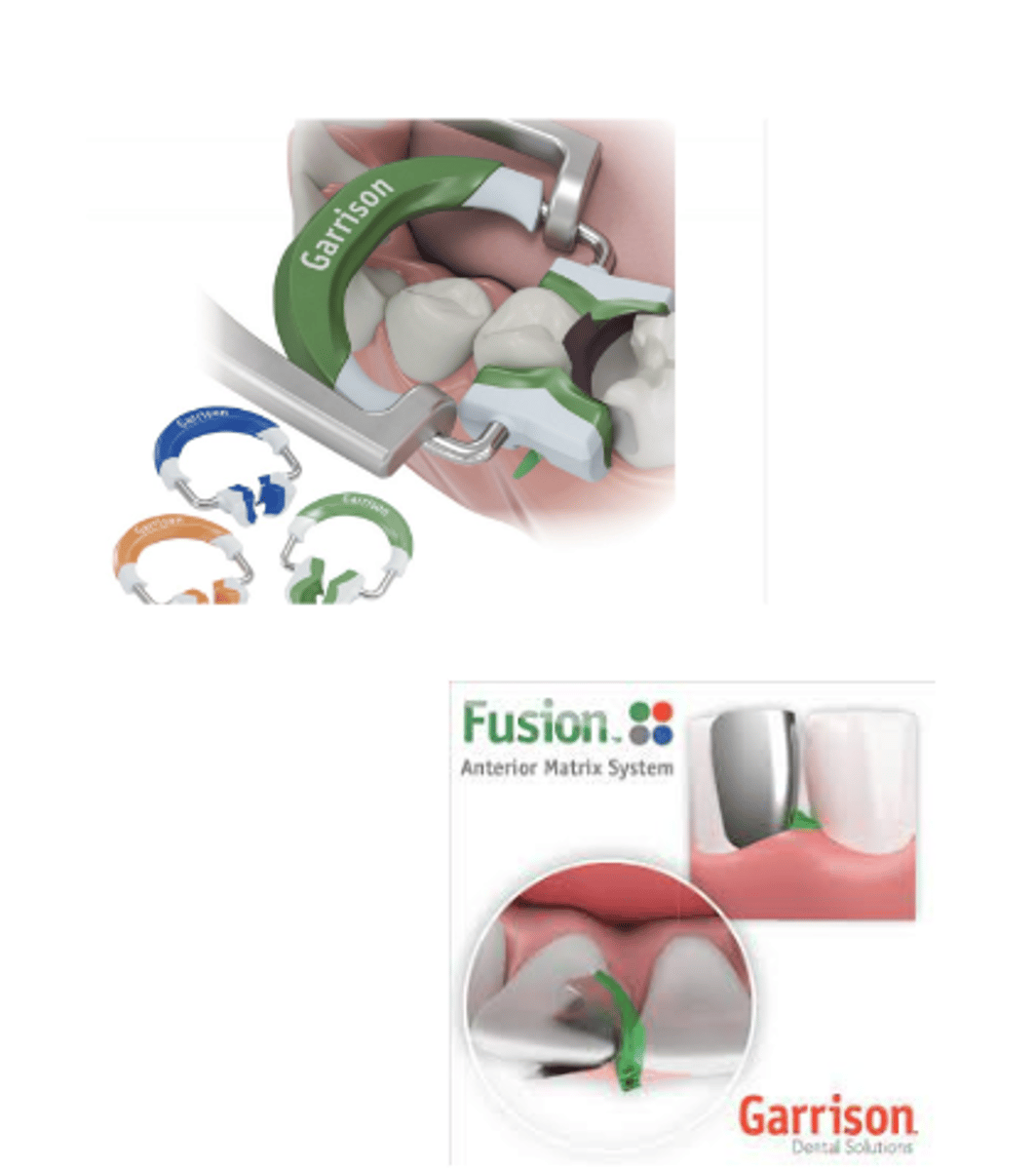 <p>Class II and III restorations</p>