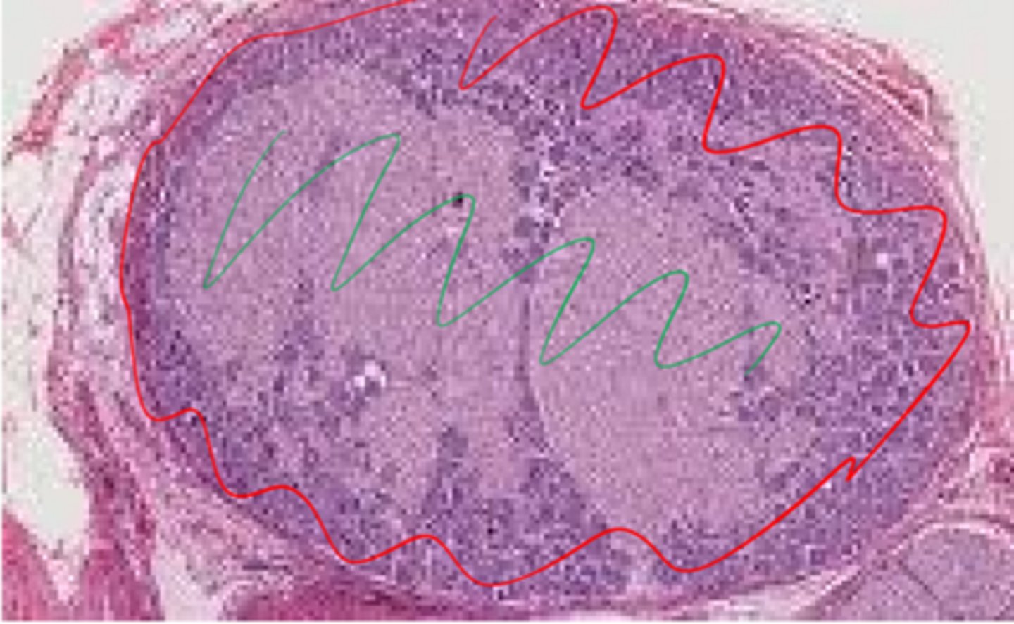 <p>This is blurry but its a dorsal root ganglion I swear.</p><p>What tends to be centrally located in the green areas?</p>