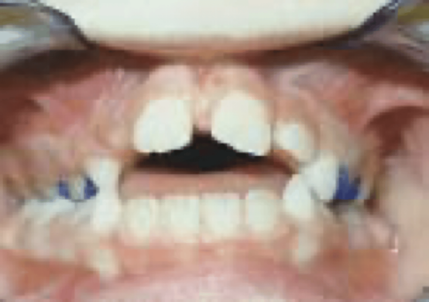 <p>tip of tongue rests above lower incisors</p>