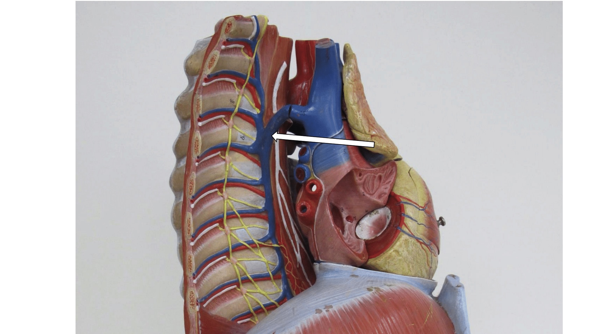<p>lateraal zicht mediastinum</p>