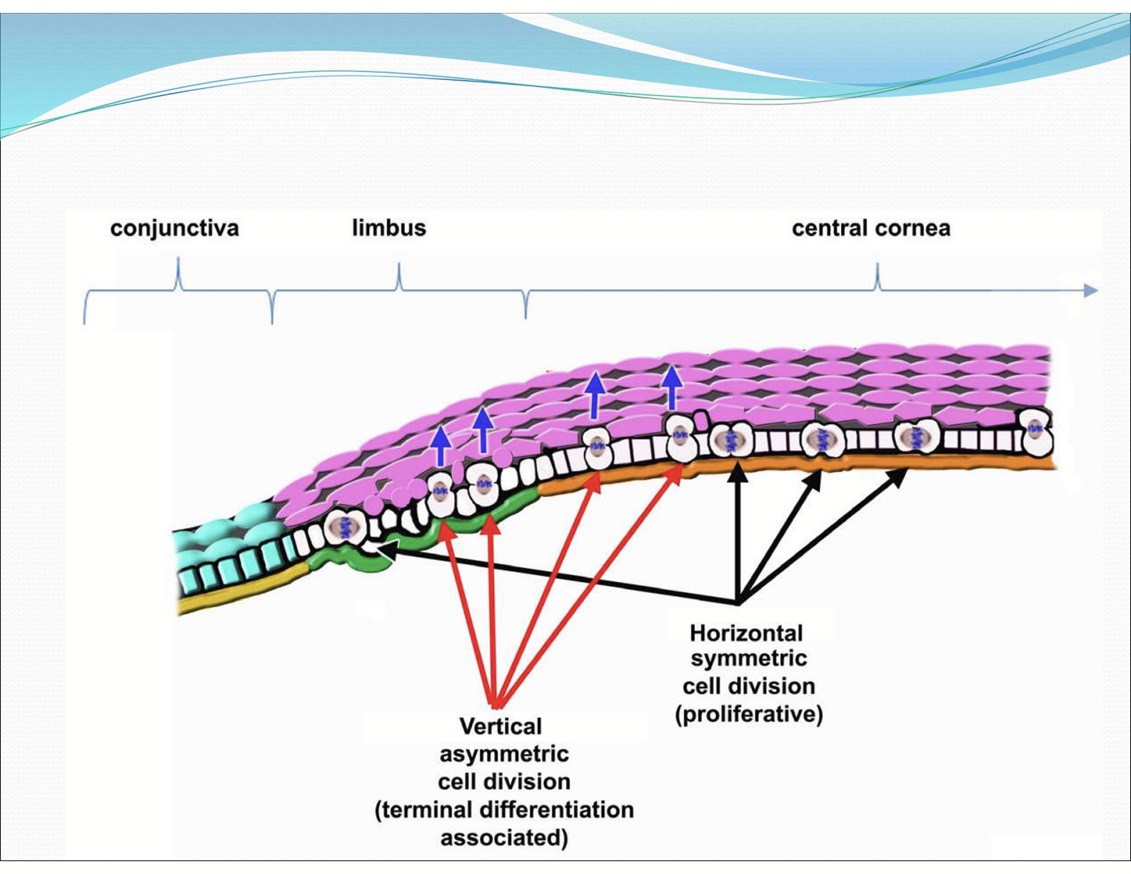 <p>Towards the central cornea</p>