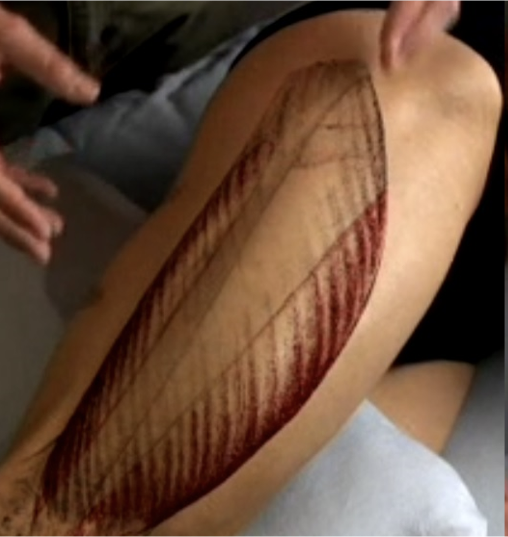 <p>Identify the vastus lateralis muscle.</p>