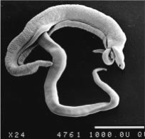 <ul><li><p>unique among trematodes</p><ul><li><p>causes schistosomiasis (snail fever)</p></li></ul></li><li><p>major disease in tropics</p><ul><li><p>200 million people infected</p></li></ul></li><li><p>dioecious</p><ul><li><p>sexual dimorphism</p><ul><li><p>females— long and slender</p></li><li><p>males— short and stout</p></li></ul></li><li><p>mate in blood circulation</p></li></ul></li><li><p>non-operculated eggs</p></li></ul><p></p>