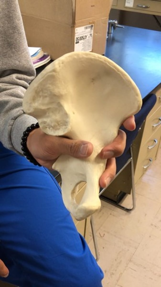 <p>Acetabulum = lateral</p><p>Iliac crest = posterior</p><p>Greater sciatic notch = posterior</p><p>(Hold like a telephone)</p>