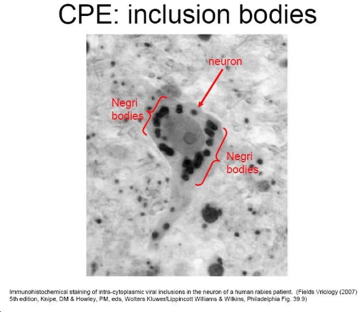 <p>structure in infected cells, sites of viral assembly</p>