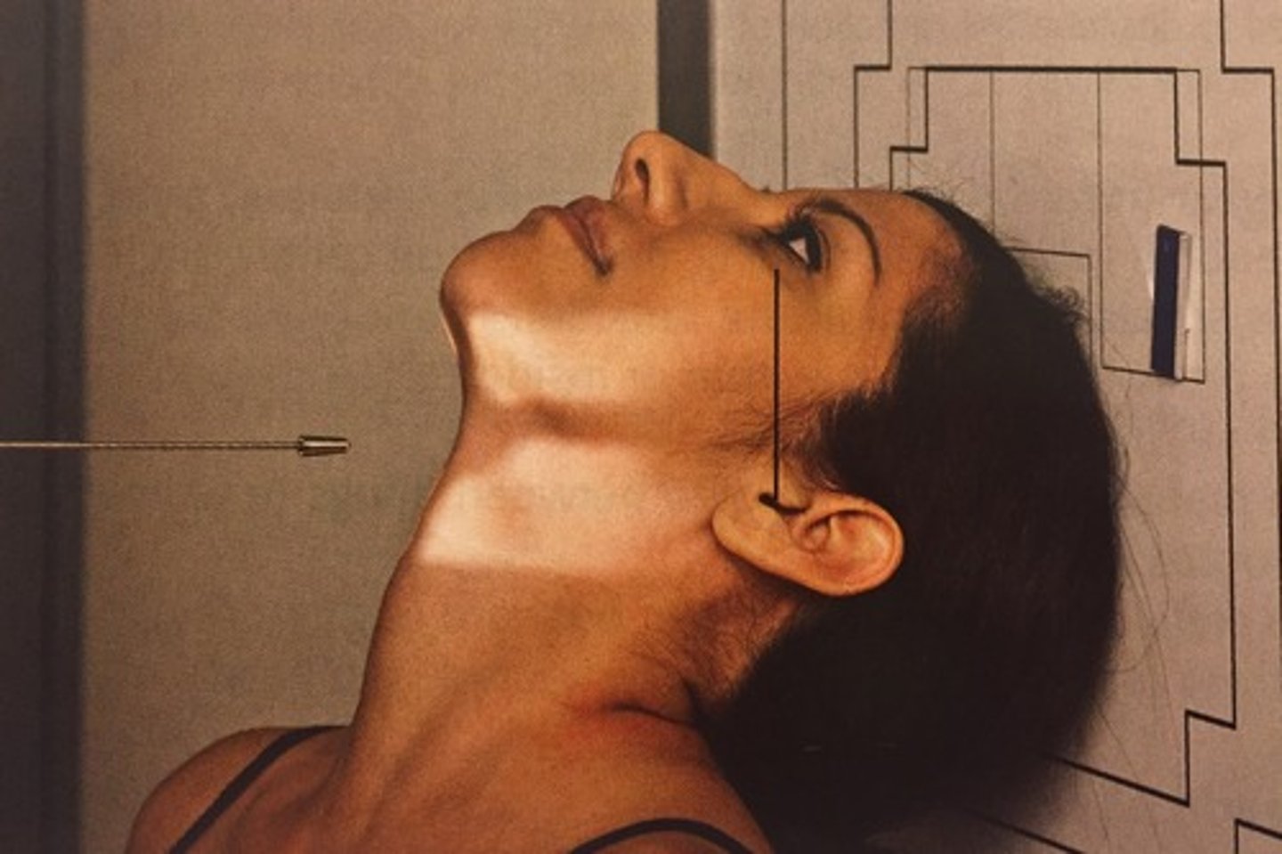 <p>Enters below the mandible and exits at the vertex of the skull</p>