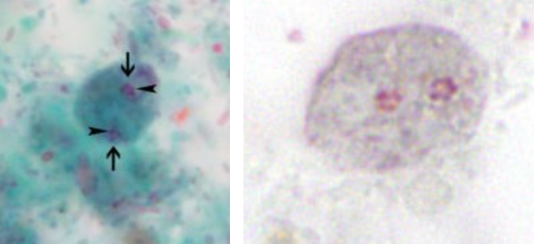 <p>Identify the organism. Give genus and species</p>