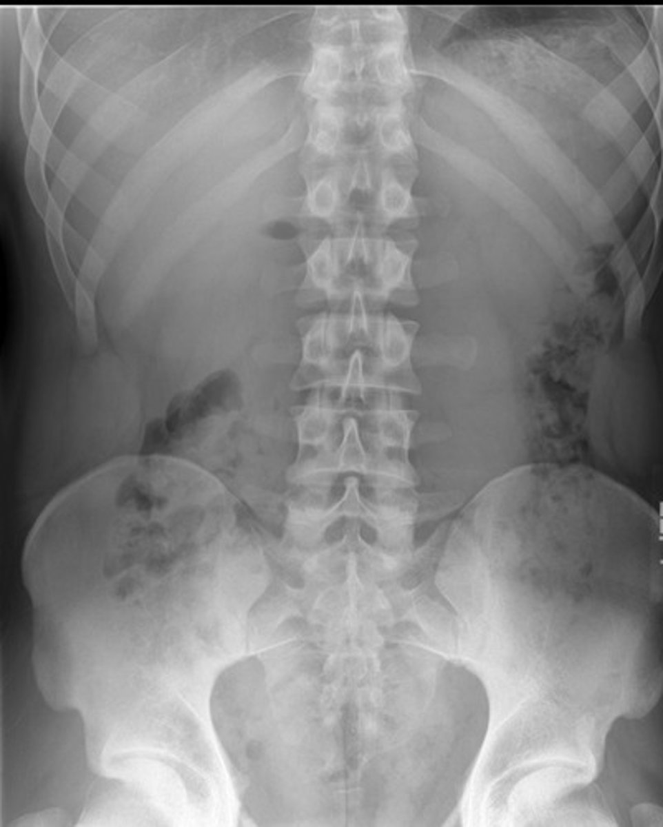 <p>What projection view is this?</p>