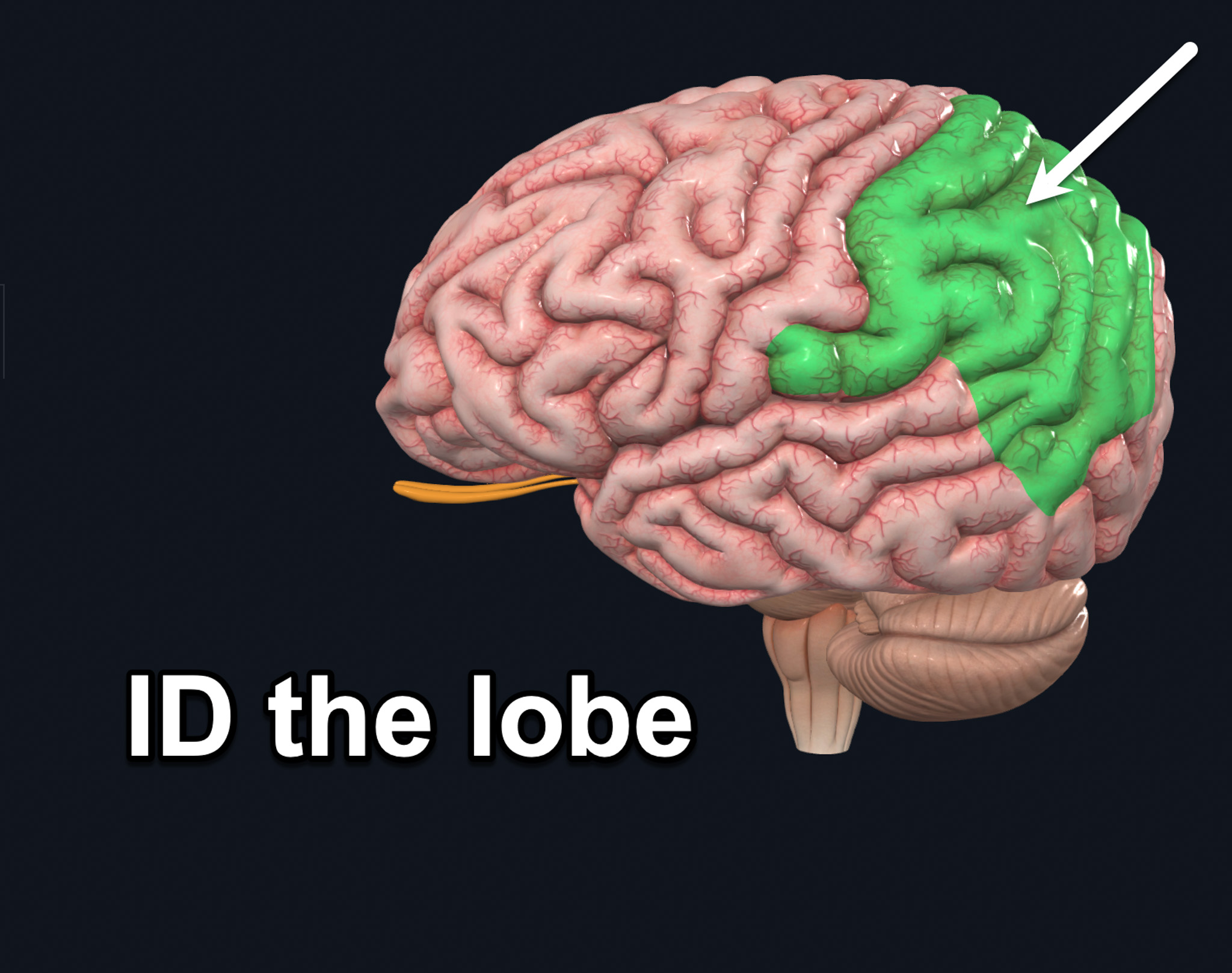 term image