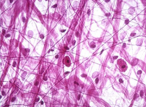 <ul><li><p><span style="background-color: transparent; font-family: "Book Antiqua", serif;"><span>Connective tissue proper</span></span></p></li><li><p><span style="background-color: transparent; font-family: "Book Antiqua", serif;"><span>Found below the epidermis</span></span></p></li><li><p><span style="background-color: transparent; font-family: "Book Antiqua", serif;"><span>Holds skin to muscle and holds organs in place</span></span></p></li><li><p><span style="background-color: transparent; font-family: "Book Antiqua", serif;"><span>Cells are known as fibroblasts and produce fibers</span></span></p></li><li><p><span style="background-color: transparent; font-family: "Book Antiqua", serif;"><span>Looks like a spider web</span></span></p></li></ul><p></p>