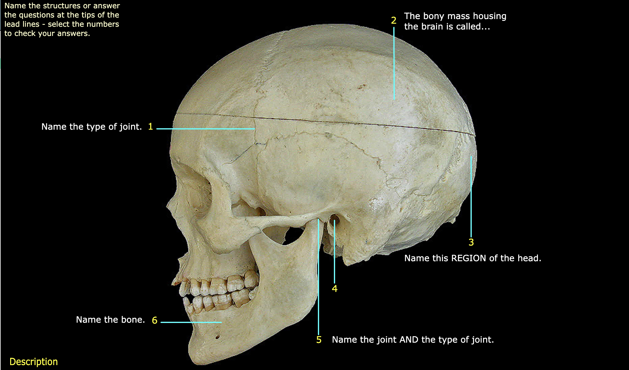 What structure is labeled 6? 