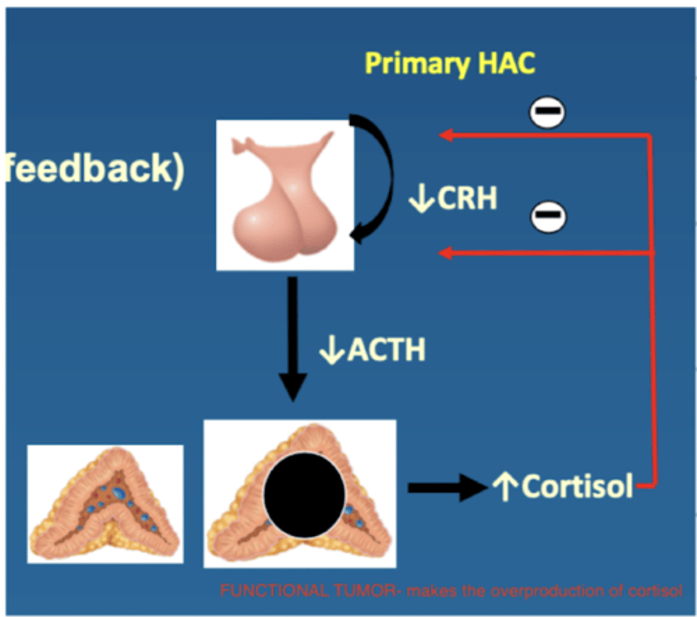 <p>↑ cortisol</p><p>↓ CRH</p><p>↓ ACTH</p>